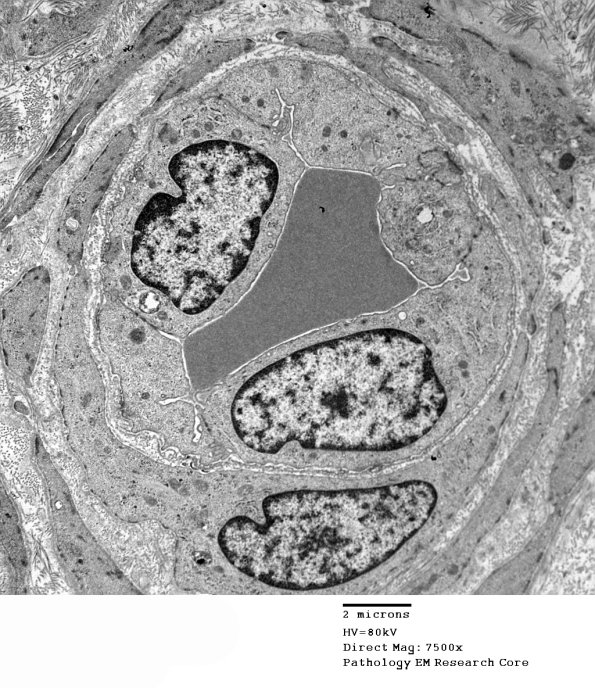 2F9 GBS (Case 2) EM 064 - Copy