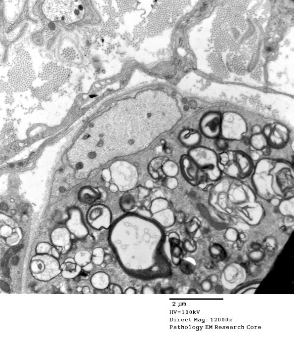 3B2A GBS (Case 3) EM 034 - Copy