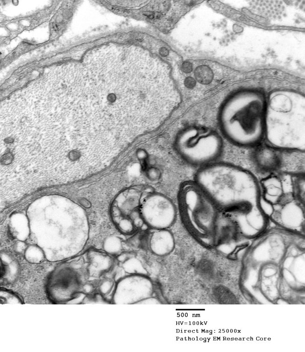 3B2B GBS (Case 3) EM 035 - Copy
