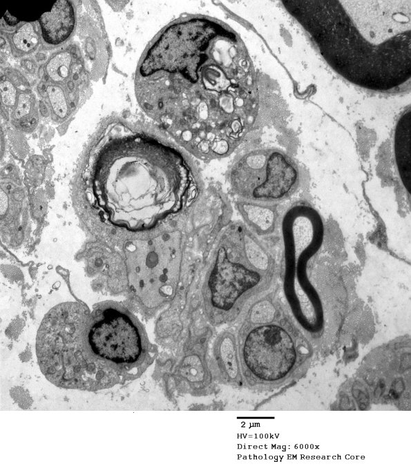 3B4A GBS (Case 3) EM 029 - Copy