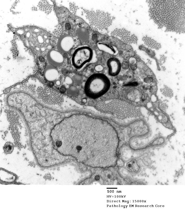 3B5 GBS (Case 3) EM 033 - Copy