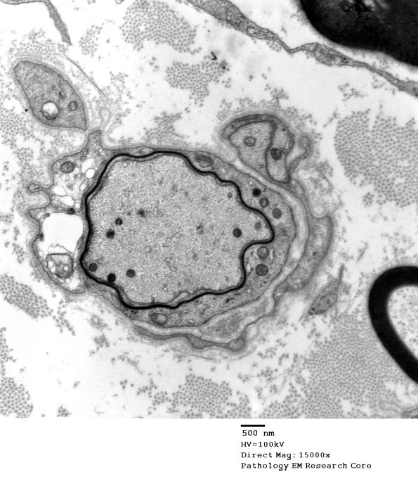 3B8 GBS (Case 3) EM 017 - Copy