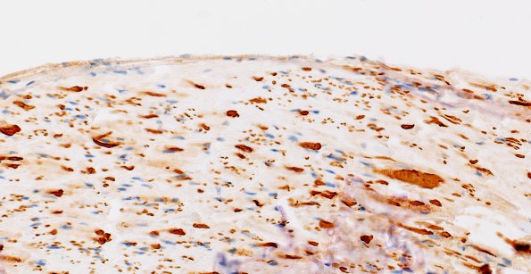 4B2 (Case 4) NF 40X 2