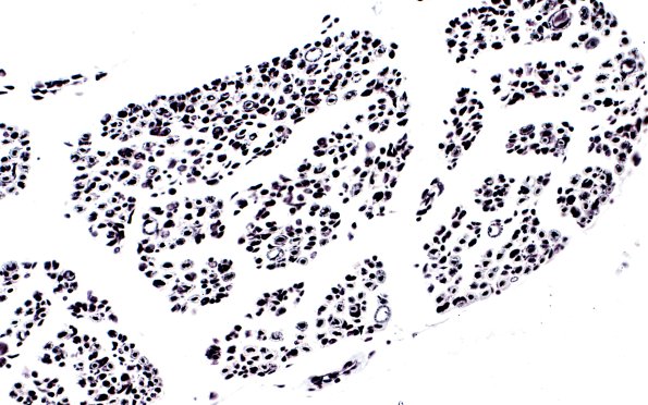 9A4 GBS (Case 9) Bodian 40X 1
