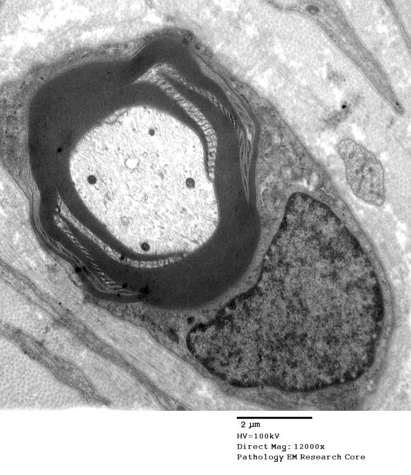 10B8 Paraprotein (Case 10)_052 - Copy