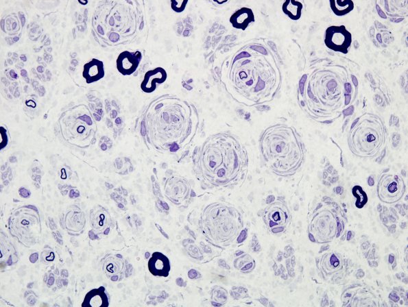 12A7 CIDP (Case 12) Plastic 3