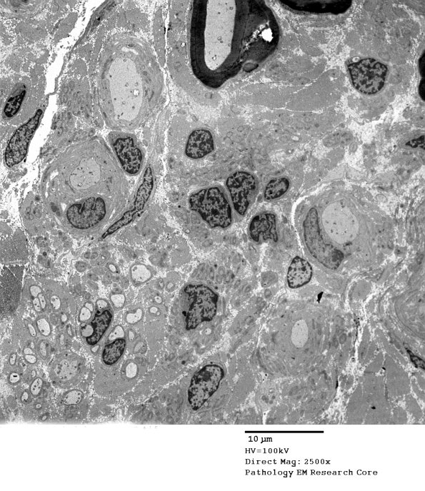 13C1 Case 13_015 - Copy