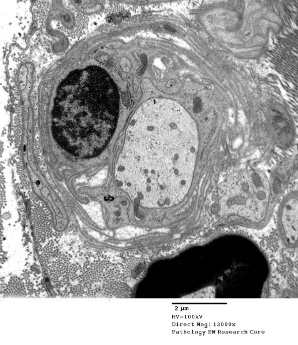 13C4 Case 13 008 - Copy