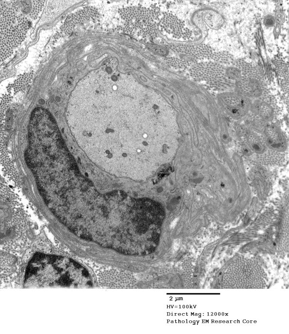 13C5 Case 13042 - Copy
