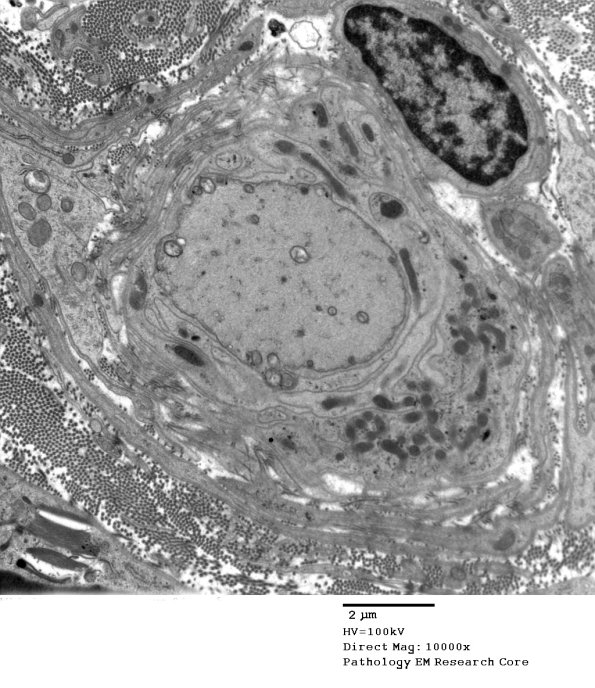 13C6 Case 13_063 - Copy