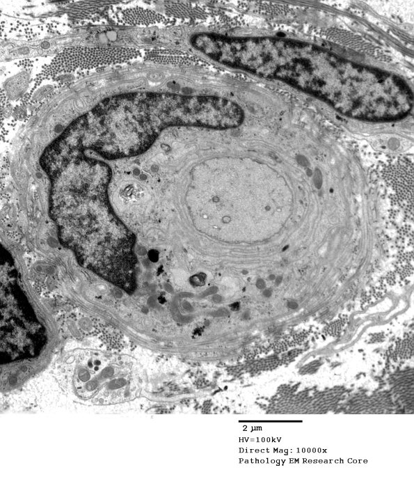 13C7 Case 13_084 - Copy