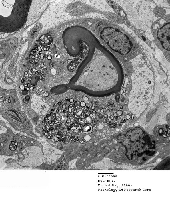 1D12A CIDP (Case 1)_023 - Copy