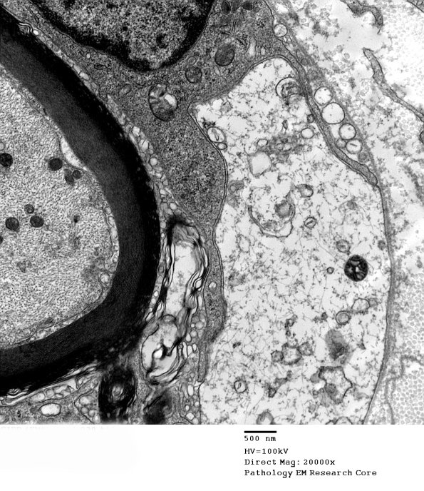 1D12D CIDP (Case 1)_029 - Copy