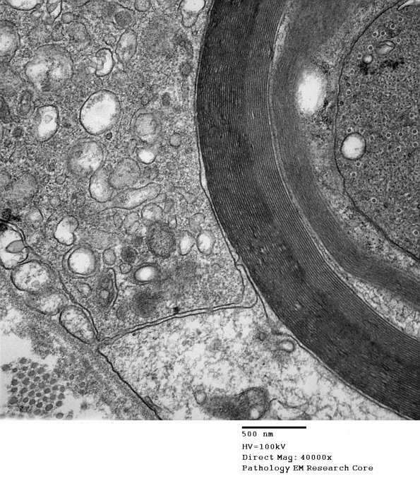 1D13B CIDP (Case 1)_012 - Copy