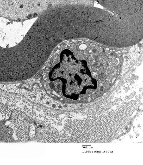 1D15 Case 1 A7 _052 - Copy