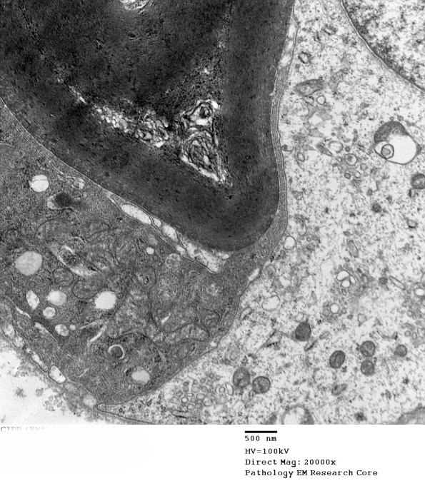 1D19B CIDP (Case 1)_033 - Copy