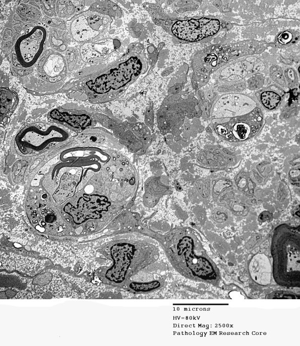 1D1A (Case 1) EM 096 - Copy
