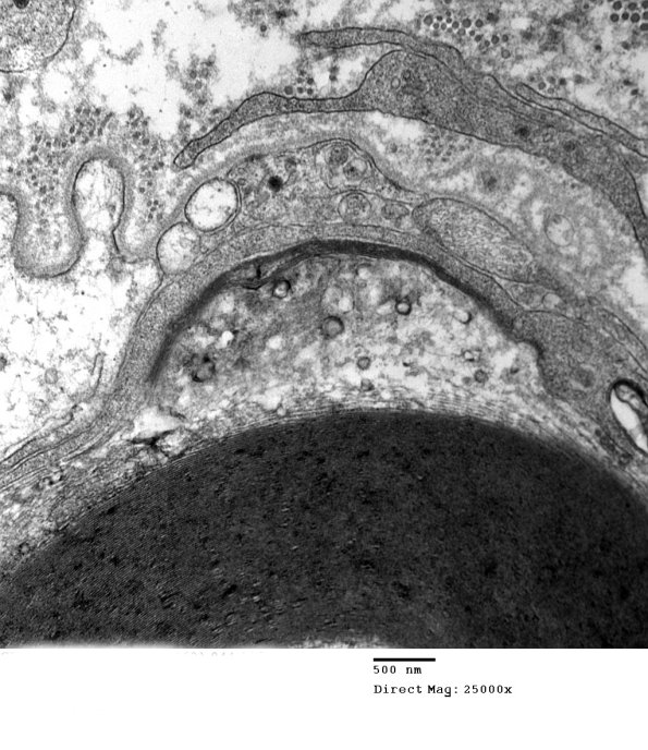 1D24B CIDP (Case 1)_044 - Copy