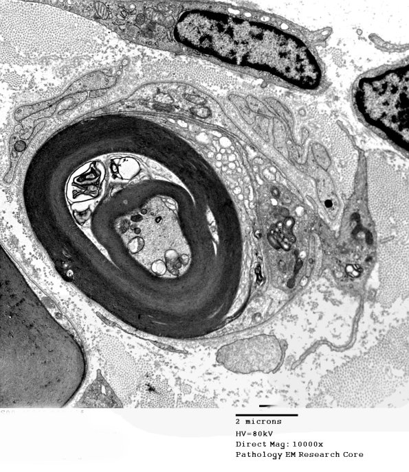 1D3 (Case 1) EM 022 - Copy