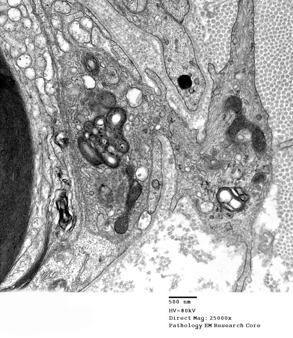 1D3 (Case 1) EM 023 - Copy