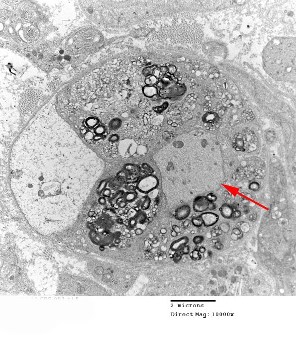 1E1 Case 1 A7 _057 copy - Copy