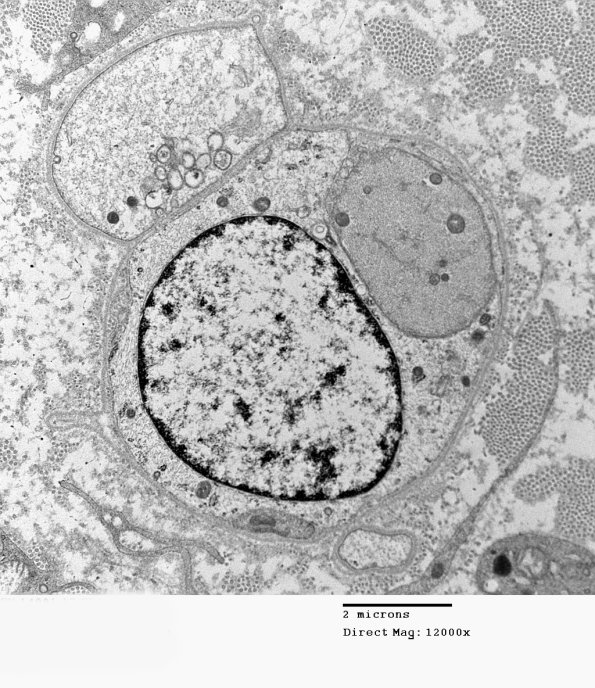 1E10 Case 1 A7 _036 - Copy