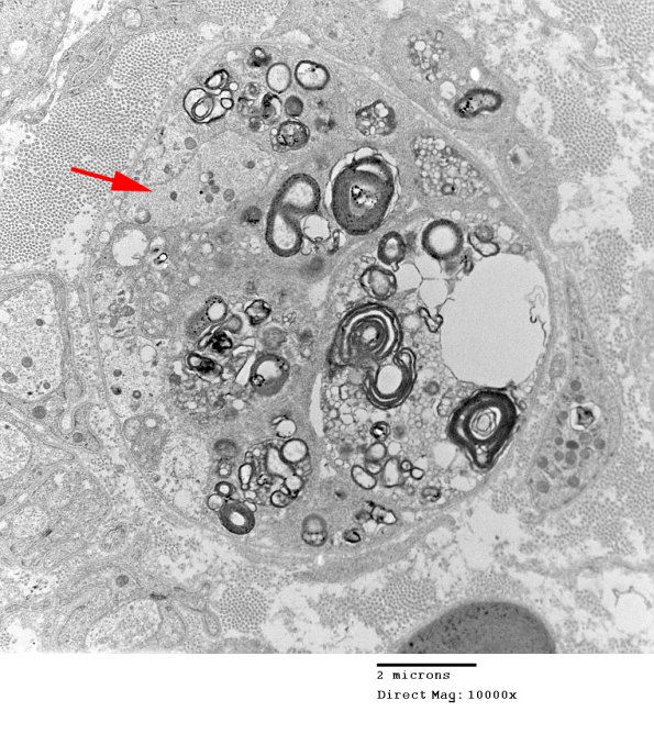 1E9 Case 1 A7 _039 copy - Copy