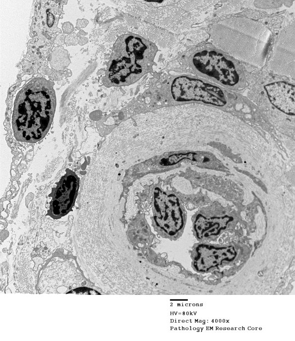 1H CIDP (Case 1) EM 091 - Copy