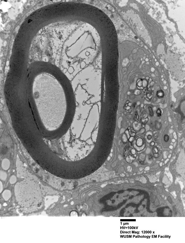 21J12B (Case 21) EM076 - Copy