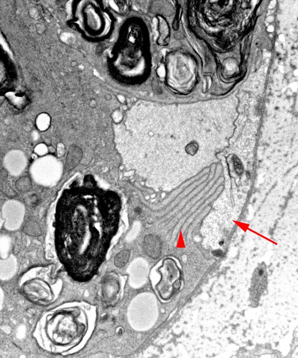 21J1C (Case 21) EM0107 focus copy - Copy