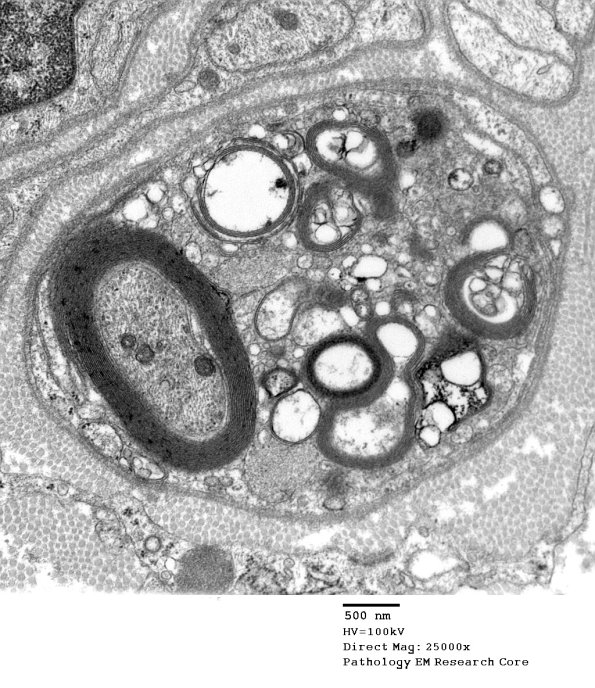 5B1 Case 5 Njerve Vicher_030 - Copy