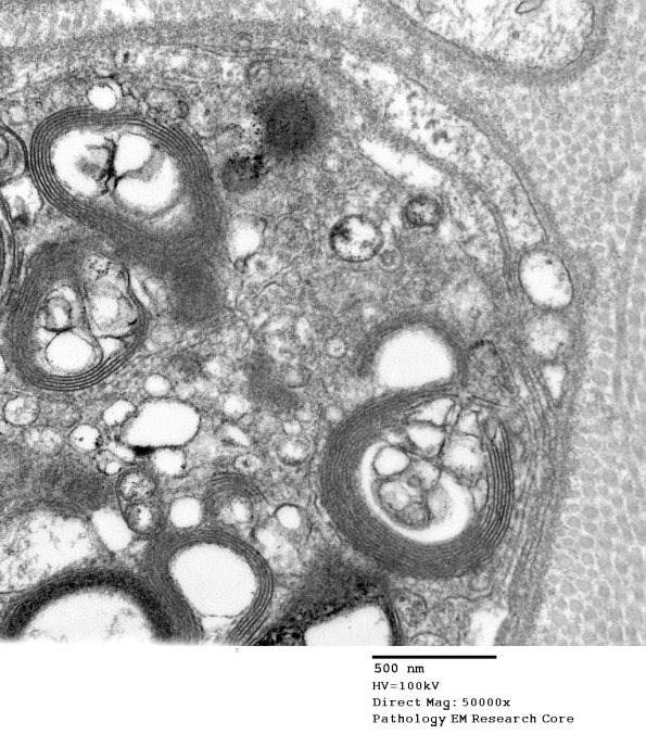 5B2 Case 5 Njerve Vicher_031 - Copy
