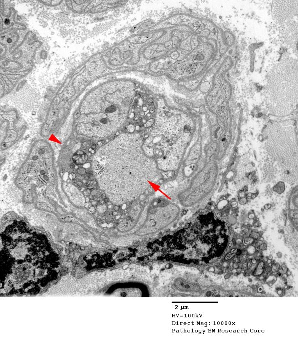5B3 Case 5 Njerve Vicher_053 copy - Copy