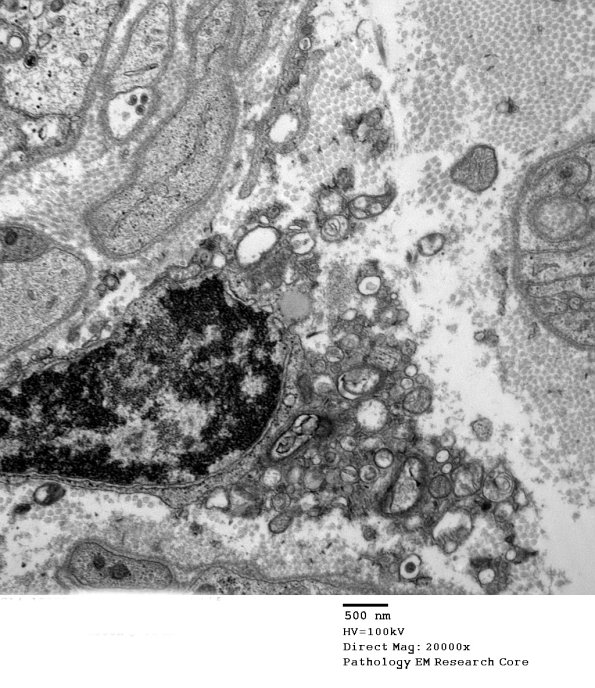 5B4 Case 5 Njerve Vicher_054 - Copy