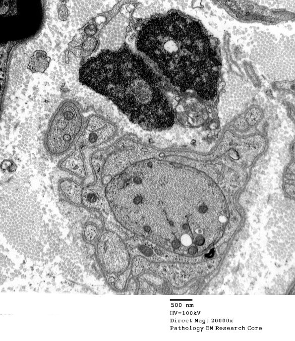 5B6 Case 5 Njerve Vicher_063 - Copy