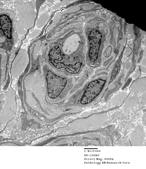 6C6 CIDP Case 6_020A - Copy