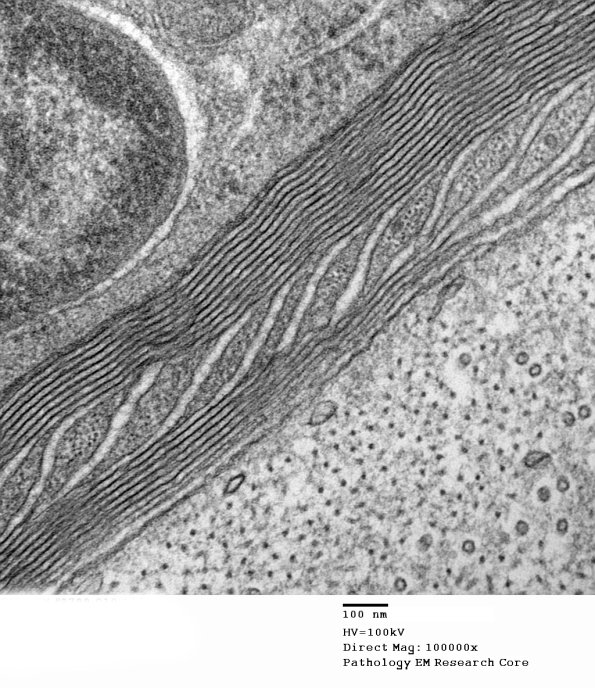 6C9 CIDP Case 6_010 - Copy