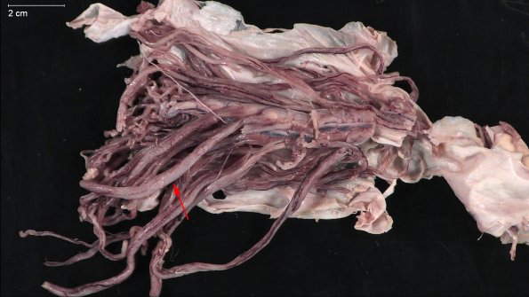 8A CIDP (Case 8) (2) copy