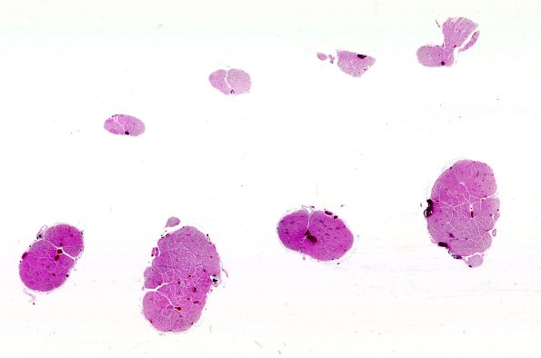 8B1 CIDP (Case 8) Roots N13 H&E whole mount 2