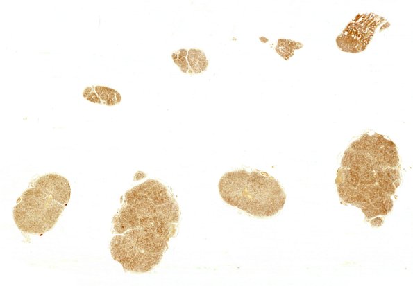 8C1 CIDP (Case 8) Roots N13 S100 whole mount