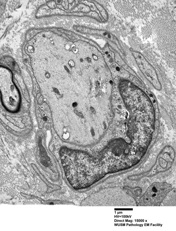 9D1 Case 9 Nerve_006A.jpg