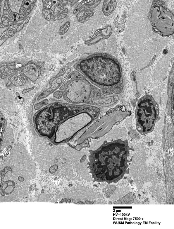 9D3 Case 9 Nerve_015A.jpg