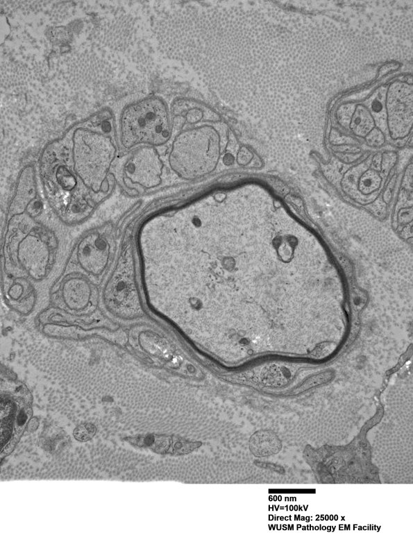 9D5 Case 9 Nerve_011A.jpg