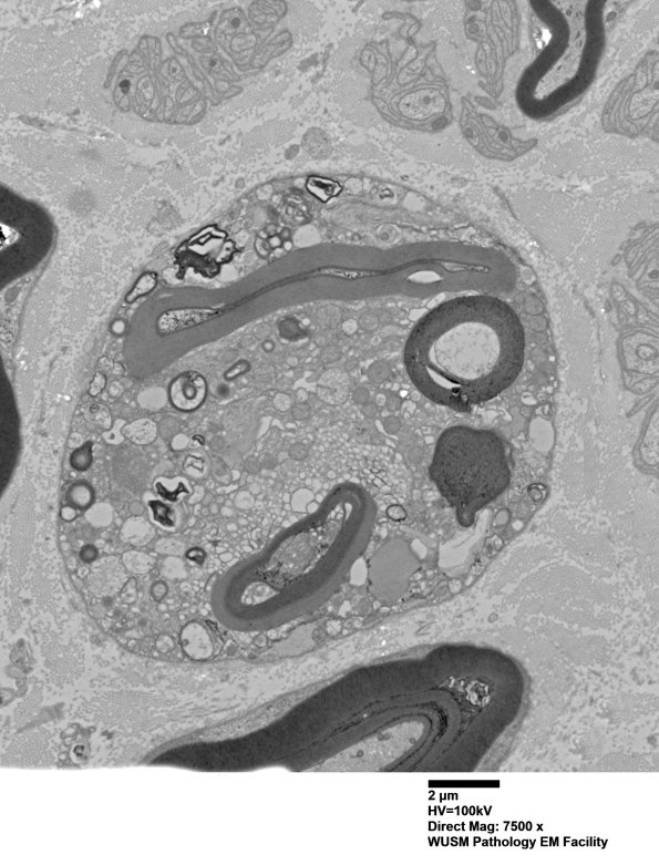 9D7 Case 9 Nerve_017A.jpg