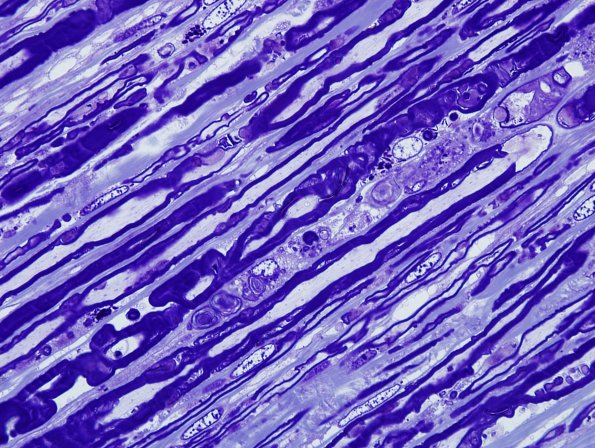 1A10 AMAN (Case 1) Plastic 8.jpg