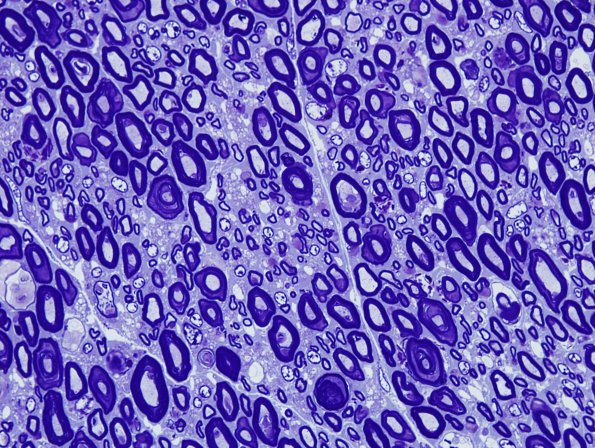 1A3 AMAN (Case 1) Plastic 9.jpg