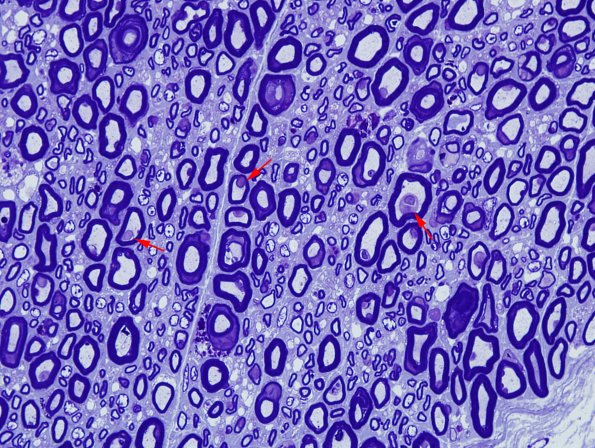 1A4 AMAN (Case 1) Plastic 20 copy.jpg