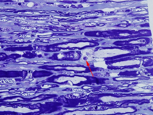 1A6 AMAN (Case 1) Plastic 6 copy.jpg