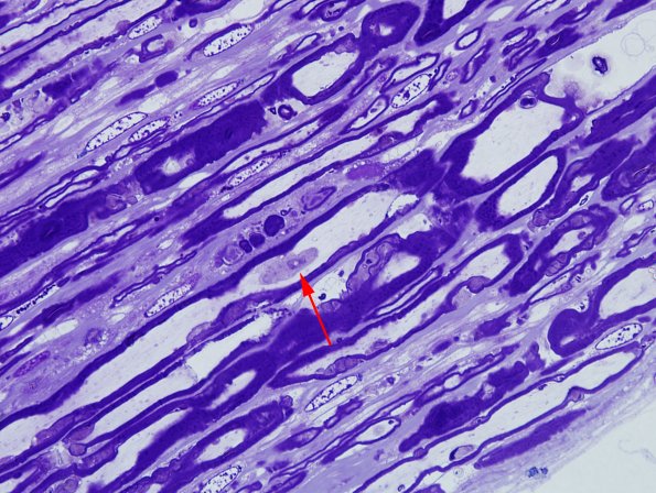 1A7 AMAN (Case 1) Plastic 17 copy.jpg