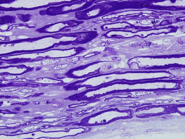 1A8 AMAN (Case 1) Plastic 19.jpg